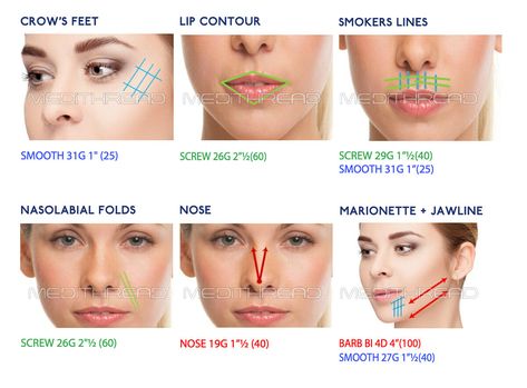 Nose Threads Before and After: Understanding the Transformation