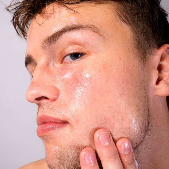 oily skin men