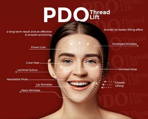 PDO Thread After Care