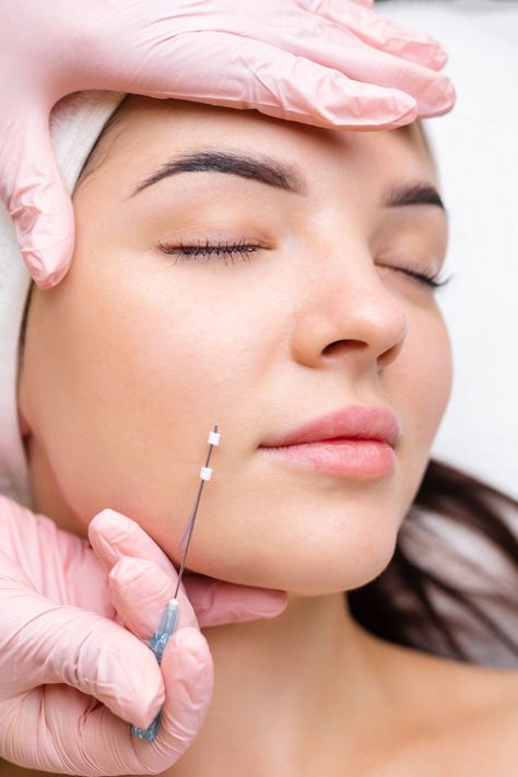 PDO Thread Lift NYC: The Ultimate Non-Surgical Facelift Solution