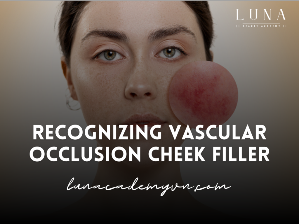 Recognizing Vascular Occlusion Cheek Filler