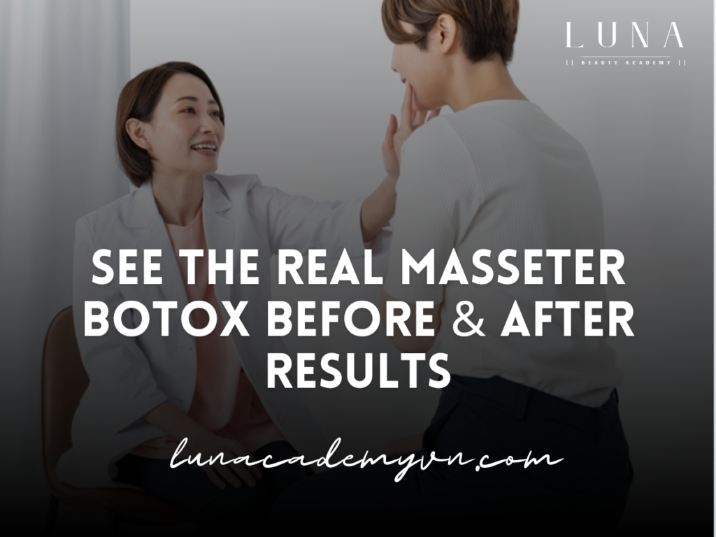 See the Real Masseter Botox Before and After Results