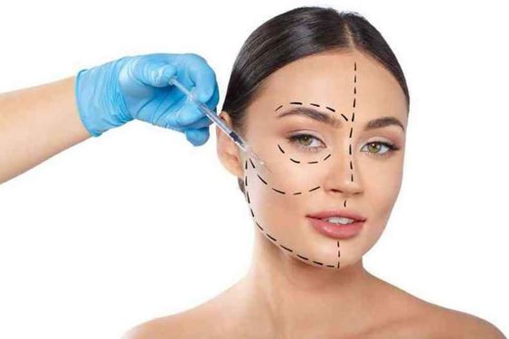 The Role of Dermal Cheeck Fillers 