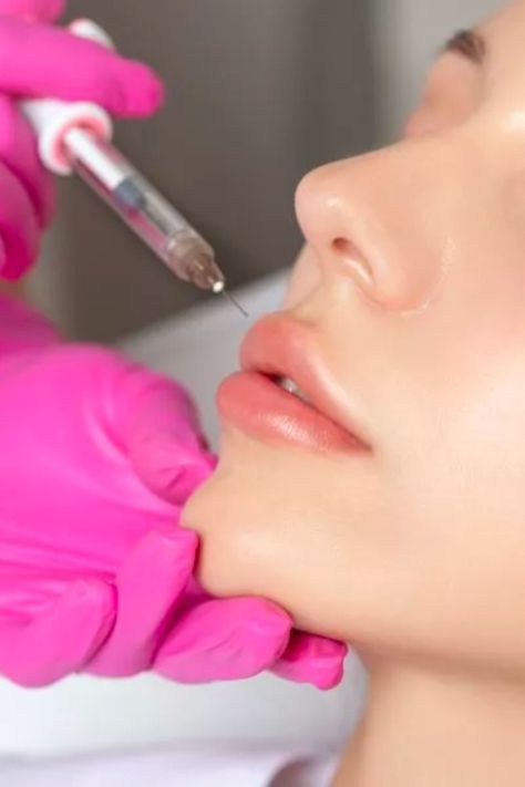 What Is Russian Lip Filler?