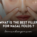 What is the best filler for nasal folds ?