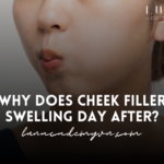 why does cheek filler swelling day after ?