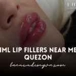 1ml Lip Fillers Near Me Quezon