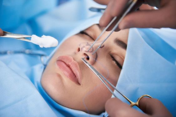 Average Rhinoplasty Philippines Price