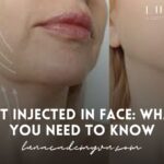 Fat Injected In Face: What You Need to Know