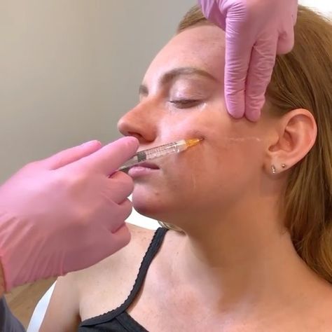 Breast Filler Injections Cost: A Comprehensive Guide