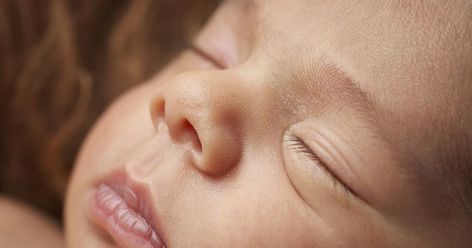 Can You Get Nose Filler While Breastfeeding?