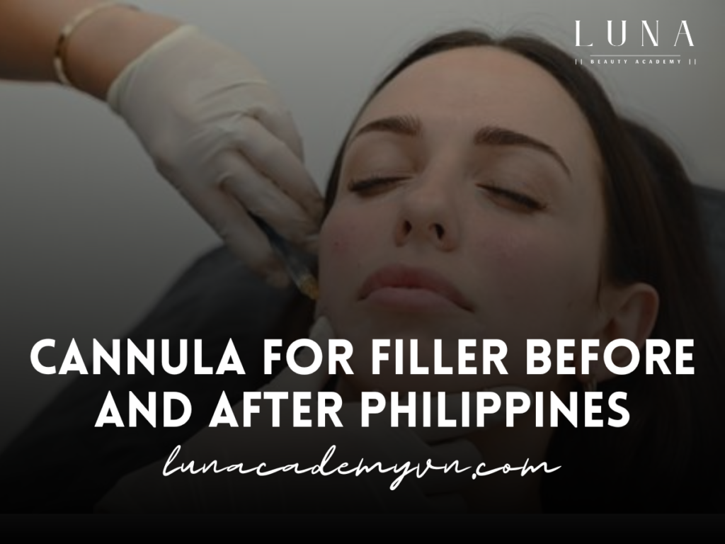 Cannula for filler before and after philippines