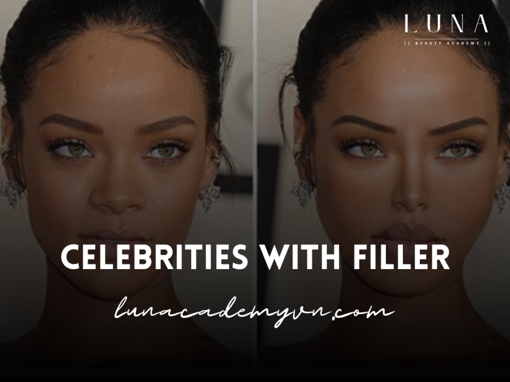 Celebrities with Filler: A Look at Stars Embracing Cosmetic Enhancements