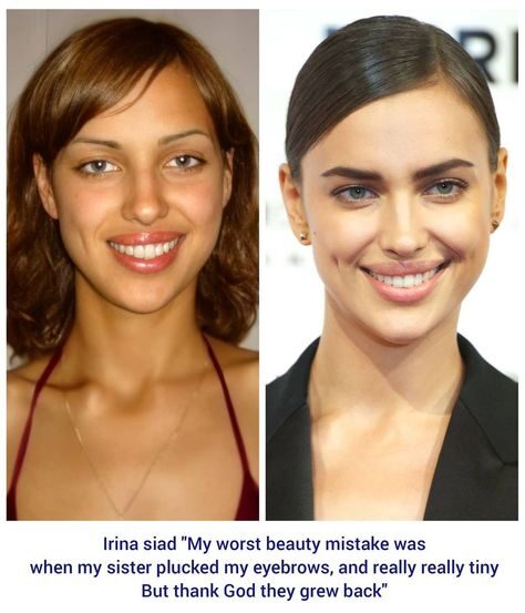 celebrities with filler