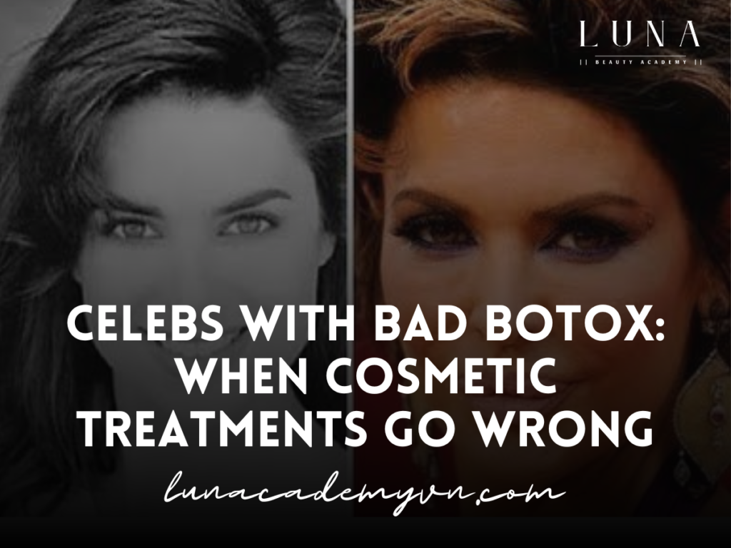 Celebs with Bad Botox