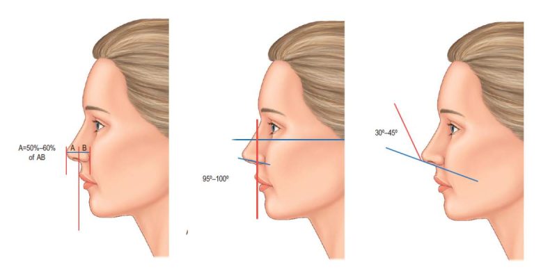 cultural-perspectives-on-nose-shape