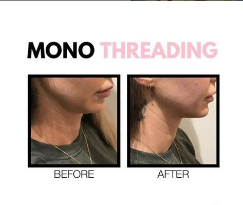 mono threads benefits