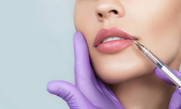 dos and don'ts after lip filler philippines