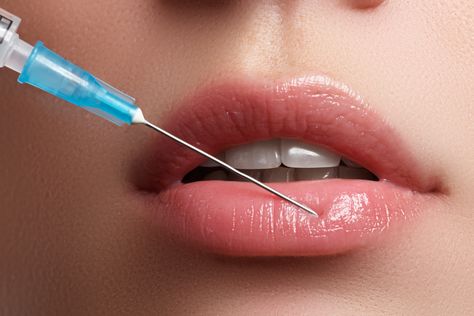 dos and don'ts after lip filler philippines