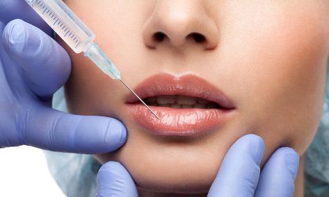 dos and don'ts after lip filler philippines