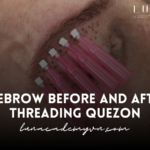 Eyebrow Before and After Threading Quezon