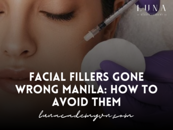 Facial Fillers Gone Wrong Manila: How to Avoid Them