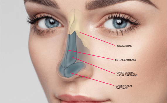 factors-influencing-rhinoplasty-costs-in-manila