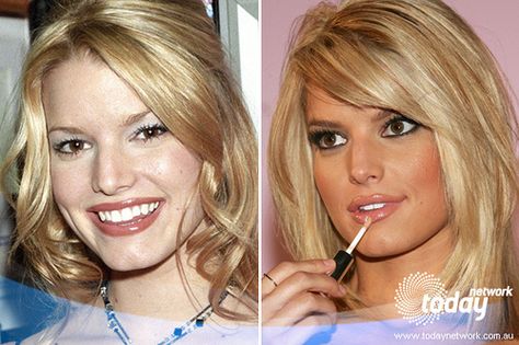  Jessica Simpson Fillers: Everything You Need to Know