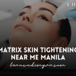 Matrix Skin Tightening Near Me Manila