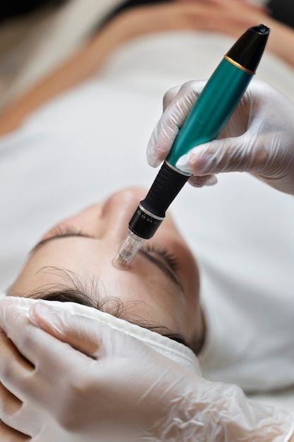 Everything You Need to Know About Needle Mesotherapy Philippines