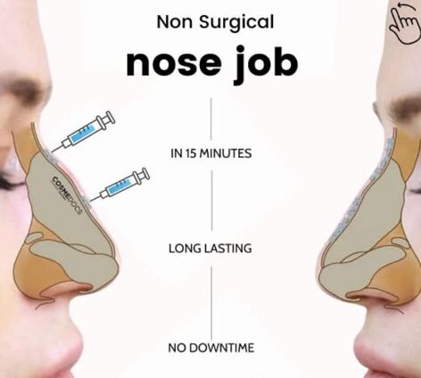 Nose Thread Extrusion Manila: Causes, Prevention, and Treatment