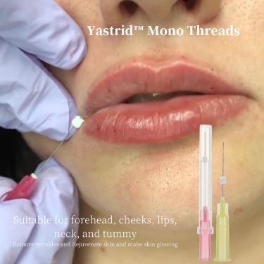 PDO Threads Lips Manila: A Comprehensive Guide