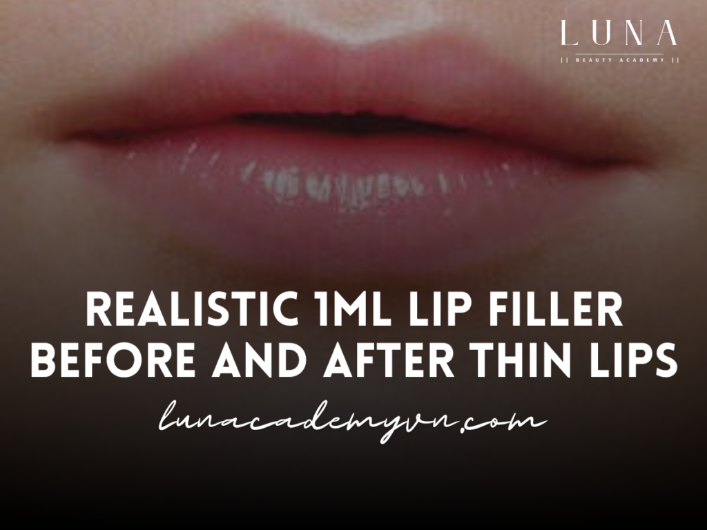 Realistic 1ml Lip Filler Before and After Thin Lips