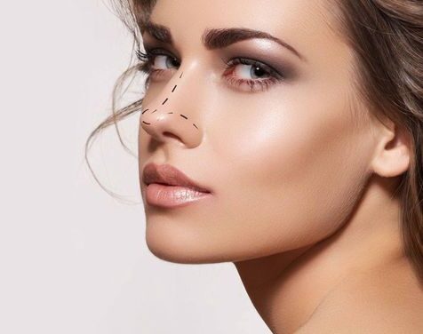 Rhinoplasty can Permanent 