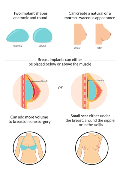 types-of-breast-fillers