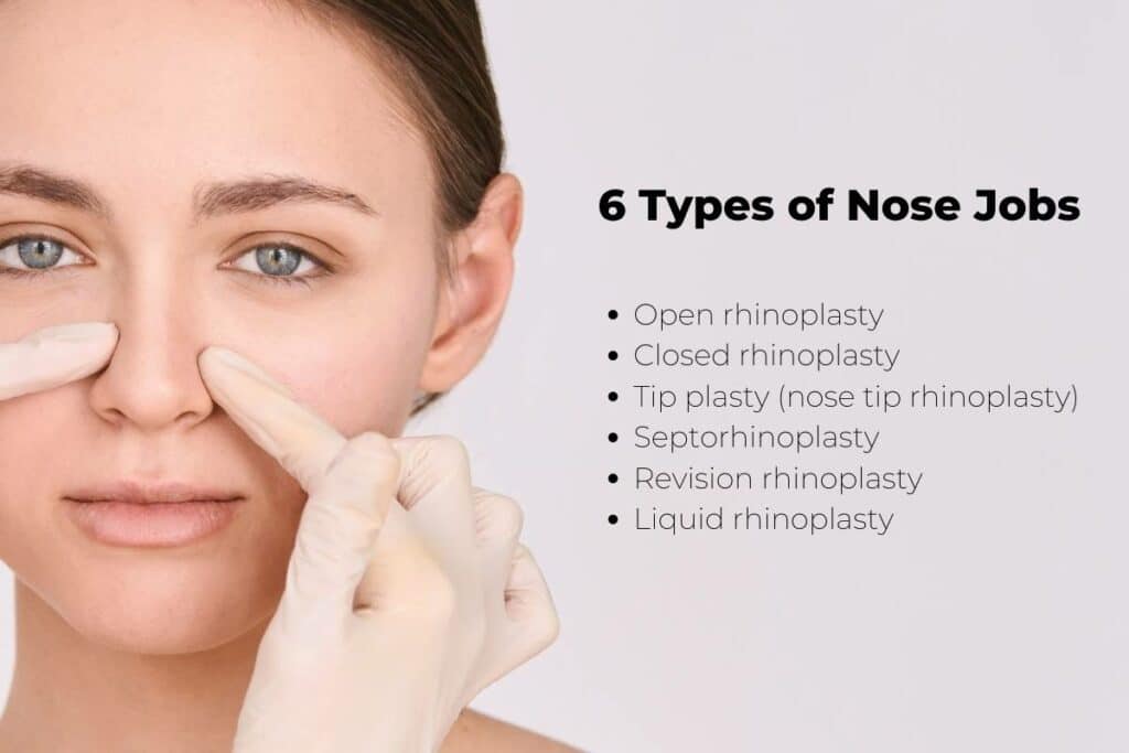 types-of-rhinoplasty-procedures