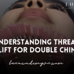 Understanding Thread Lift for Double Chin