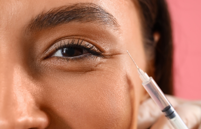 Unveiling the Youthful Gaze A Journey into Under Eye Filler