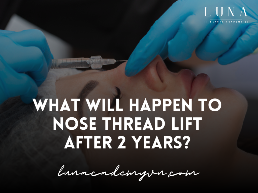 What will happen to nose thread lift after 2 years?