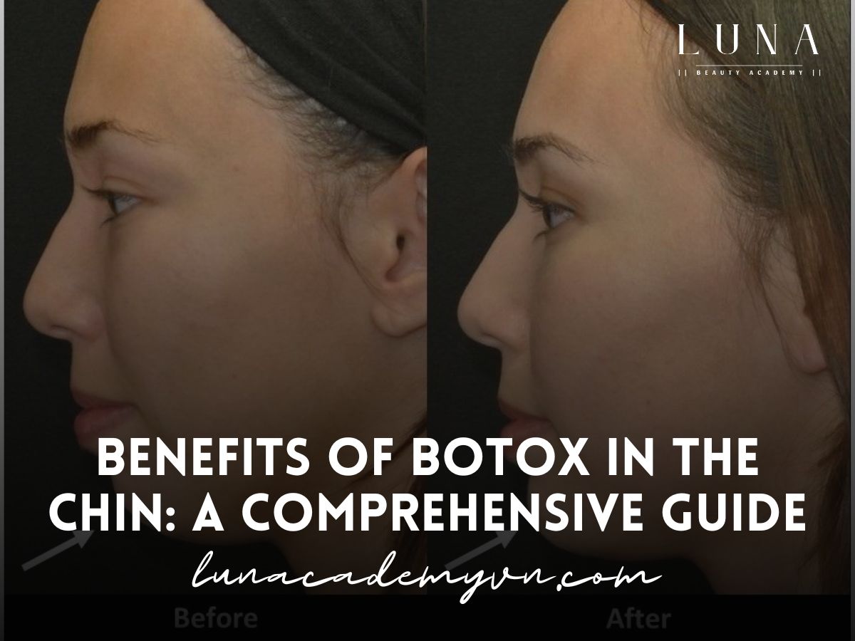 Benefits of Botox in the Chin A Comprehensive Guide