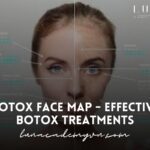 Botox Face Map – Effective Botox Treatments