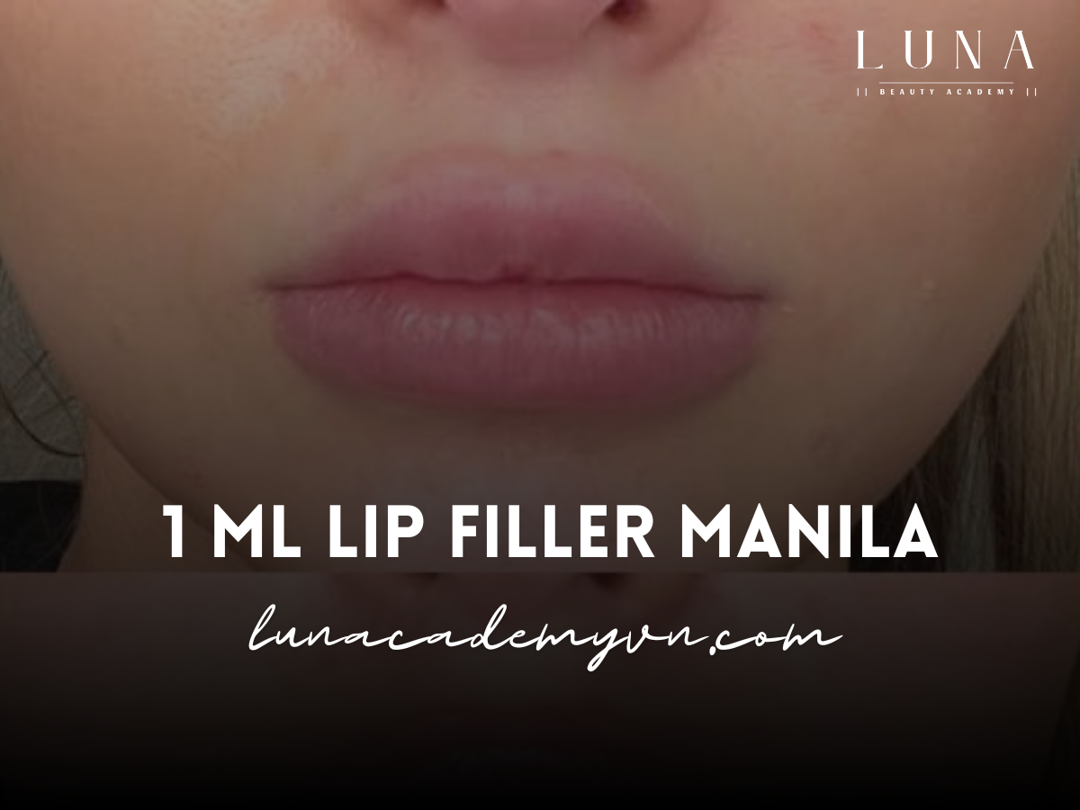 1 ml Lip Filler Manila: Enhance Your Natural Beauty