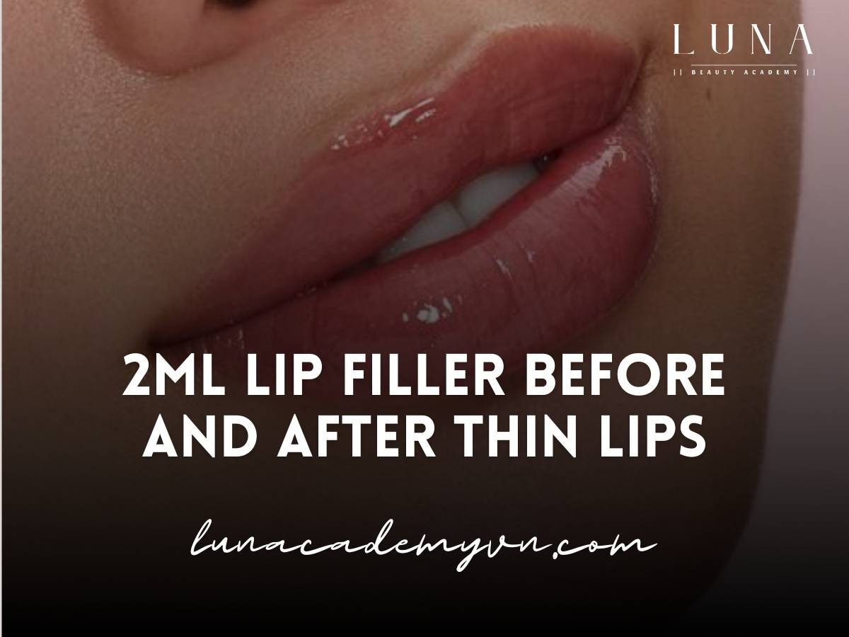 2ml Lip Filler Before and After Thin Lips