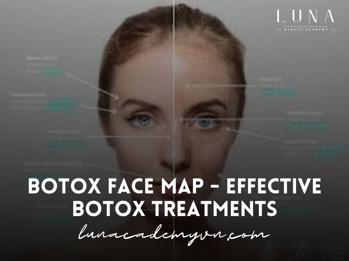 Botox Face Map - Effective Botox Treatments