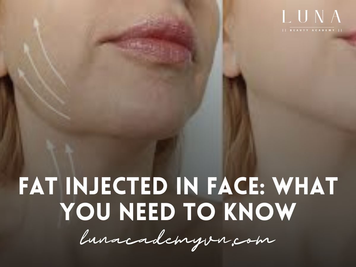 Fat Injected In Face - What You Need to Know