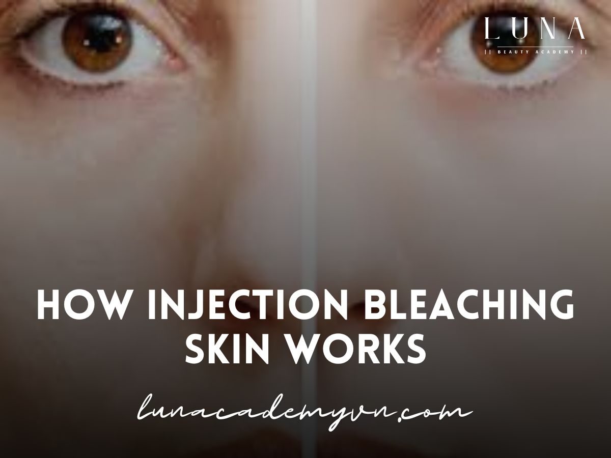 How Injection Bleaching Skin Works