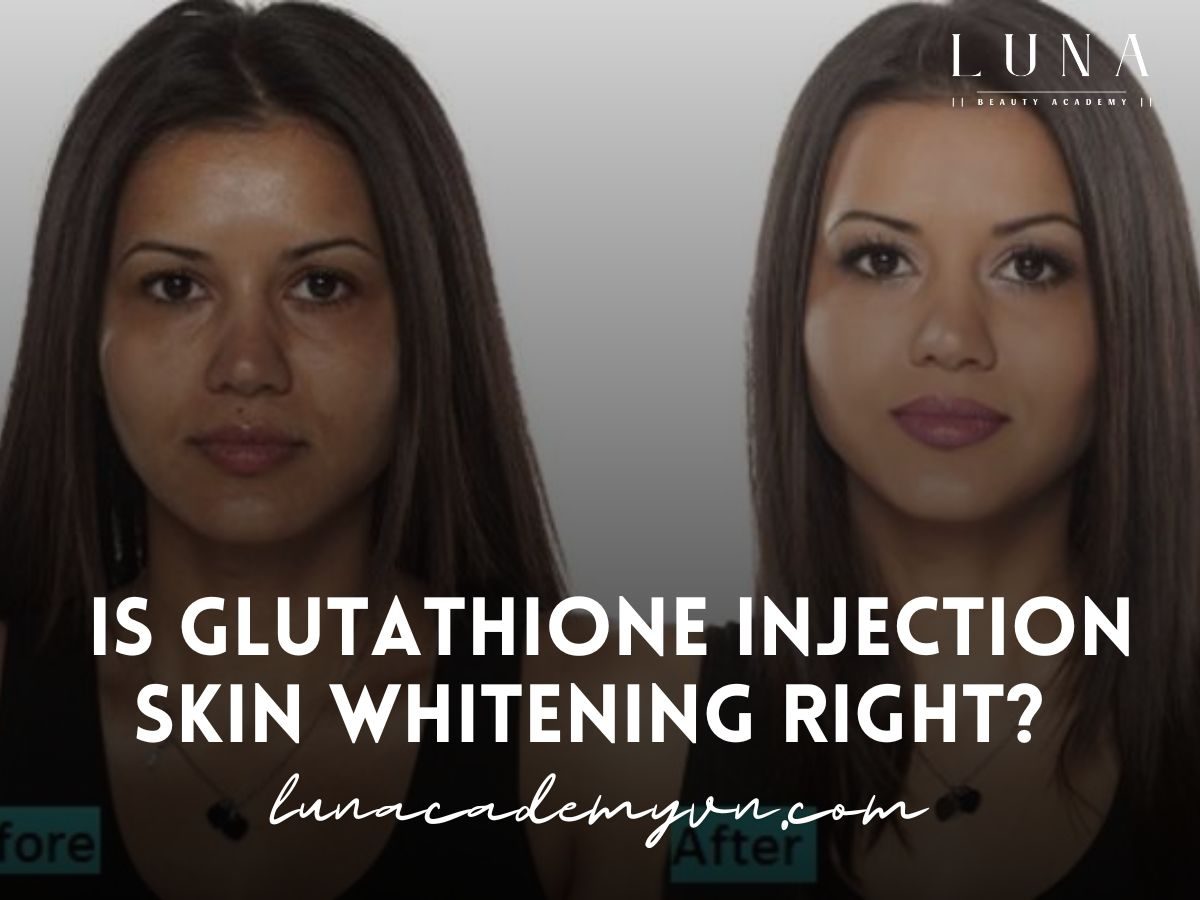 Is Glutathione Injection Skin Whitening Right