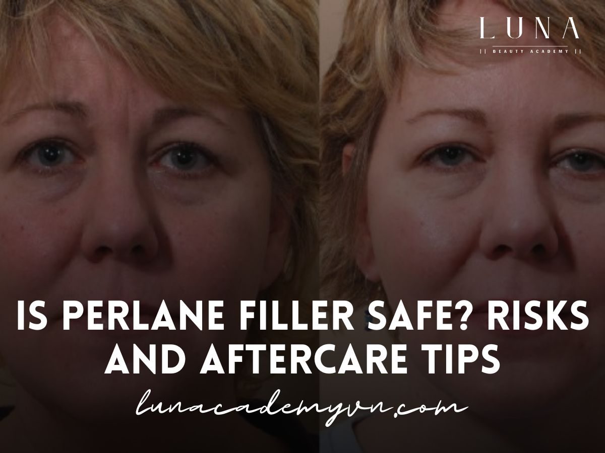 Is Perlane Filler Safe? Risks and Aftercare Tips