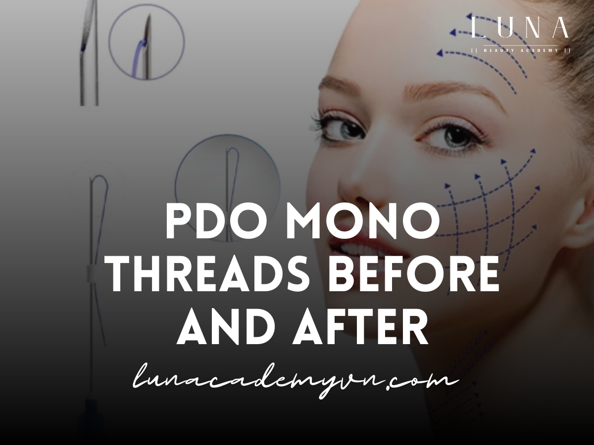 PDO Mono Threads Before and After