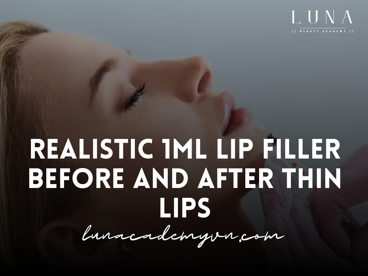 Realistic 1ml Lip Filler Before and After Thin Lips